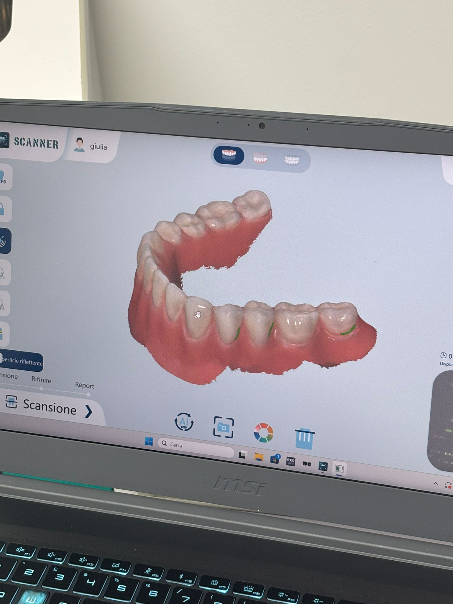 Scanner Dentale 3D