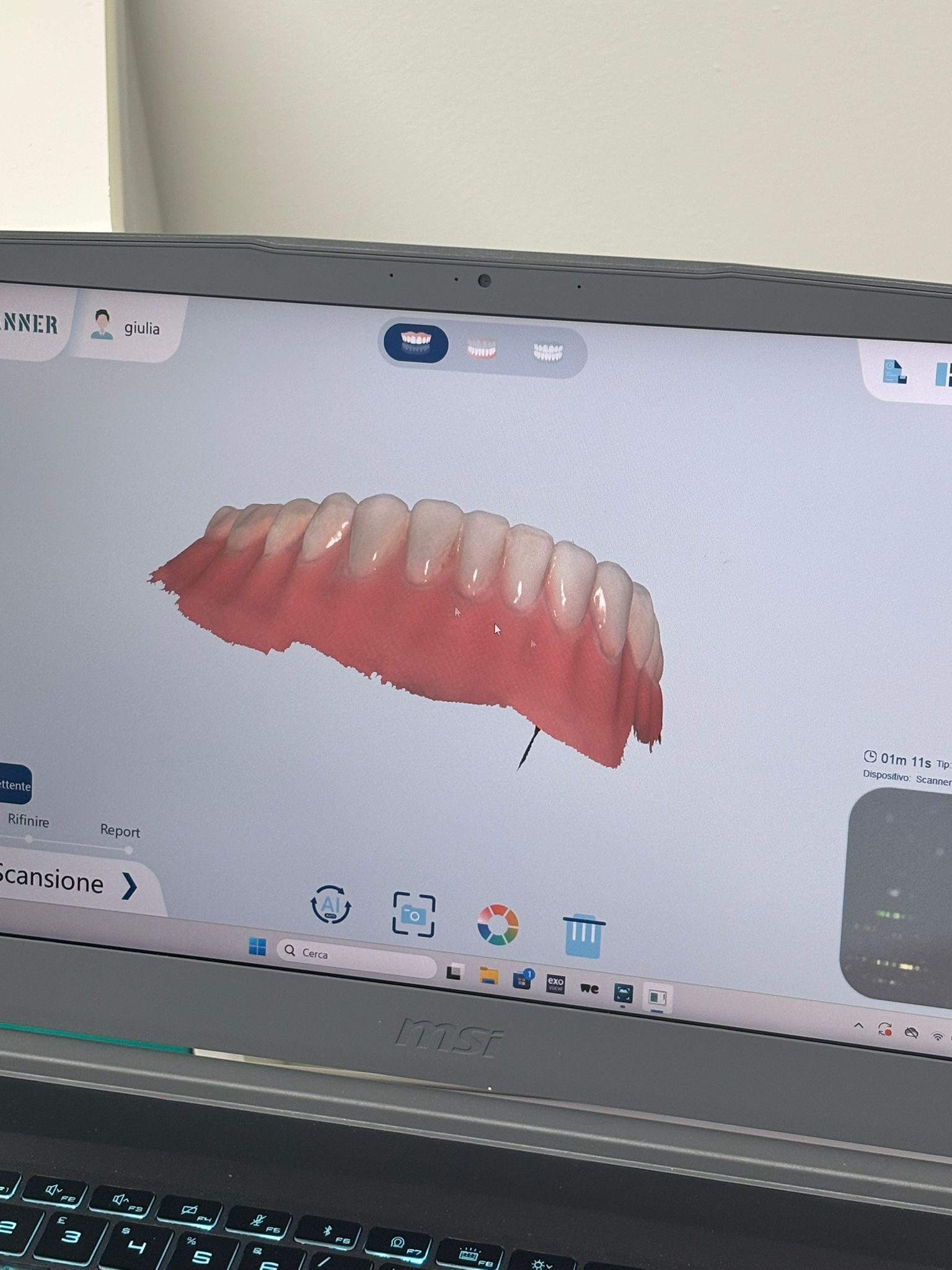 Scanner Dentale 3D