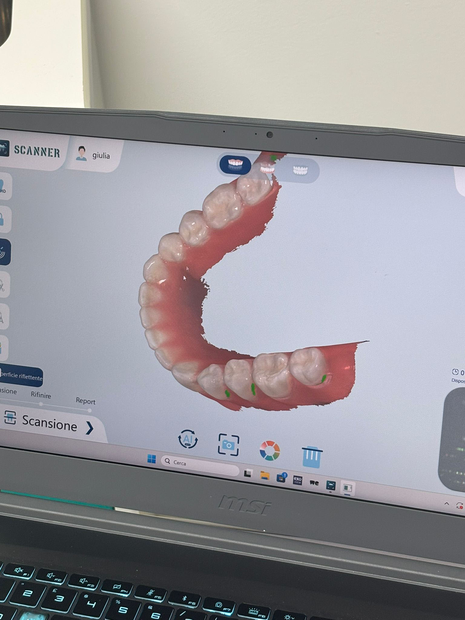Scanner Dentale 3D